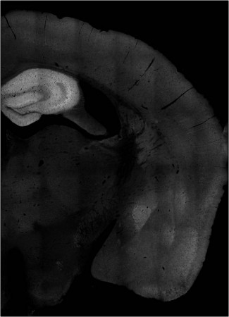 Pyk2 expression pattern in mouse brain